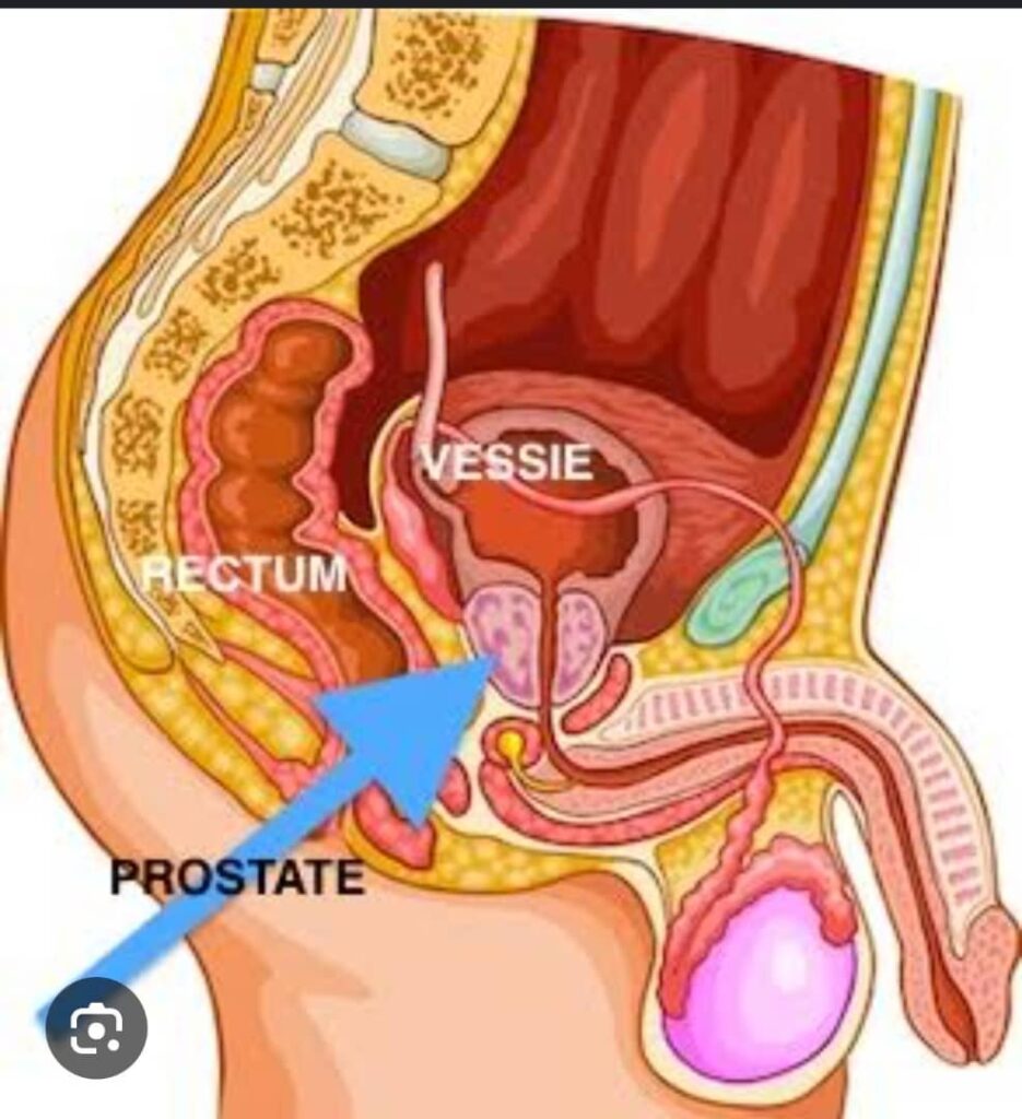 Santé : Voici ce qu’il faut faire pour éviter et réduire les risques de cancer de la prostate